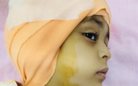 कोटा- एमबीएस अस्पताल में 4 वर्षीय बच्ची का कोकलियर इम्प्लांट, जन्म से सुनने और बोलने में असमर्थ थी बच्ची