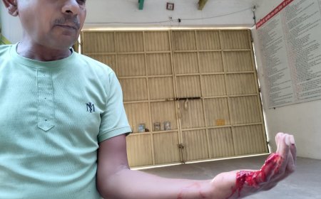 कोटा: खेत की रखवाली कर रहे किसान को कुत्ते ने काटा