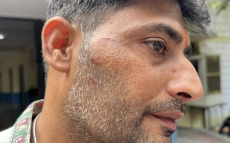 कोटा: मतदान के बाद विवाद, वार्ड 23 के भाजपा प्रत्याशी पर मतदाता से मारपीट का आरोप