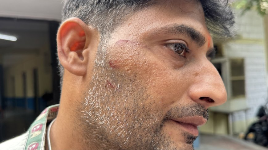 कोटा: मतदान के बाद विवाद, वार्ड 23 के भाजपा प्रत्याशी पर मतदाता से मारपीट का आरोप